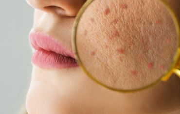 Bariera hydrolipidowa skóry – fundament zdrowej cery i skutecznych terapii